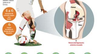 El castigo del futbolista, conoce todos los detalles sobre la lesión de ligamento cruzado de la rodilla 