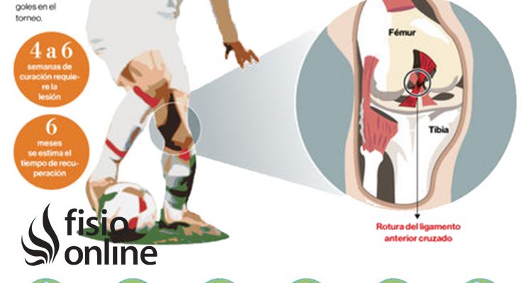 El castigo del futbolista, conoce todos los detalles sobre la lesión de ligamento cruzado de la rodilla 