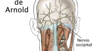 Neuralgia u occipitalgia de Arnold. Descubre sus causas, consecuencias y tratamiento