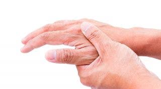 Artritis reumatoide ¿Qué es? ¿Cómo tratarla?