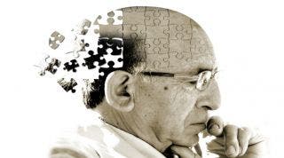Enfermedad de Alzheimer y otras demencias. Aspectos básicos del tratamiento de Fisioterapia