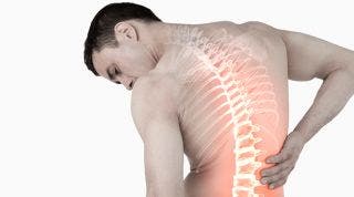 ¿En qué consiste el tratamiento de fisioterapia del acuñamiento vertebral?