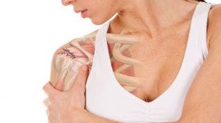 Lesión de hombro: Tendinitis del supraespinoso. ¿Qué es? Causas, ejercicios y tratamiento