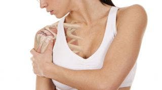 Desgarro o rotura del manguito rotador del hombro. Causas, síntomas y tratamiento