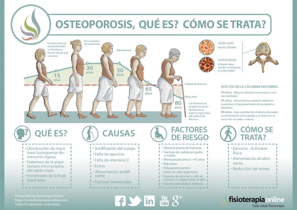 osteoporosis_osteopenia_perdida_de_masa_osea